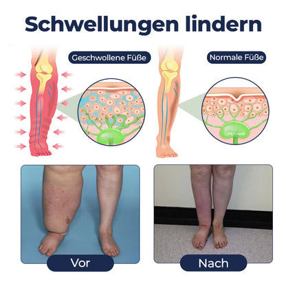 Timilk® SwellRelief Durchblutungsunterstützende Creme