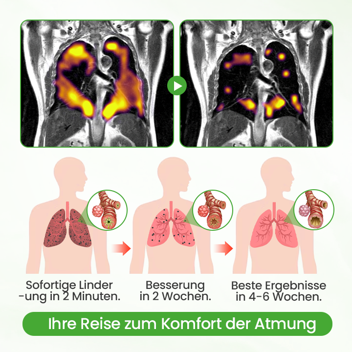 Timilk® HerbaAir Mullein Lungenreiniger