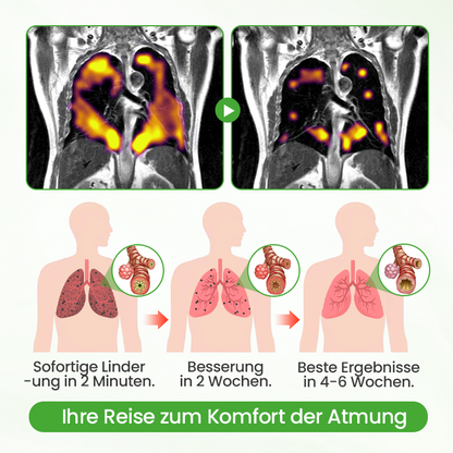 Timilk® HerbaAir Mullein Lungenreiniger