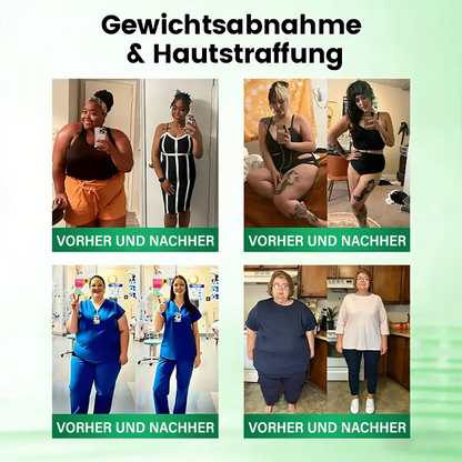 Offizieller Store | ☀️☀️ Timilk® Moringa · Berberin × NAD+ 10-in-1 Advanced Nano-Mikronadel-Patch (Nur einmal täglich anwenden – sichtbare Veränderungen in 7 Tagen)