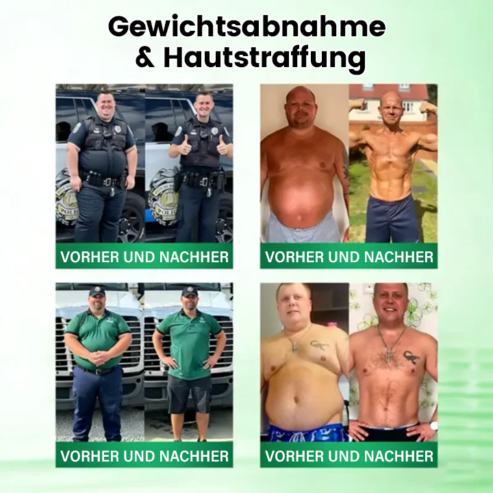 Offizieller Store | ☀️☀️ Timilk® Moringa · Berberin × NAD+ 10-in-1 Advanced Nano-Mikronadel-Patch (Nur einmal täglich anwenden – sichtbare Veränderungen in 7 Tagen)