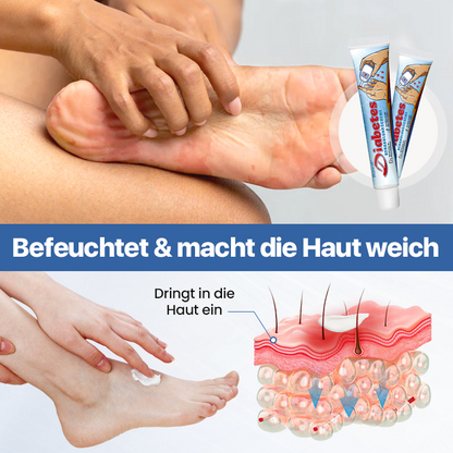 Biancat® VitaGluco Diabetes-Behandlungscreme✅Fördert schnellere Heilung diabetischer Wunden